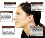 Illustration of different types of headaches. - Copyright – Stock Photo / Register Mark